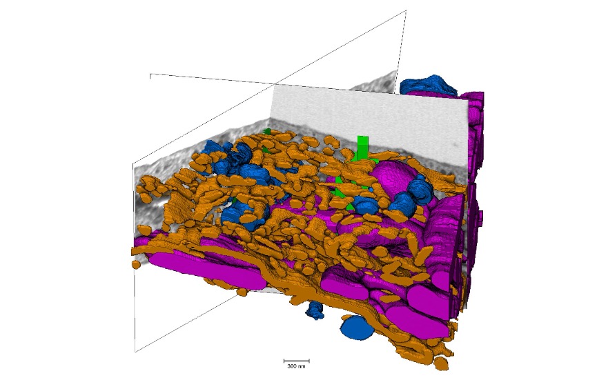 3D volume electron microscopy segmentation of a HEK cell